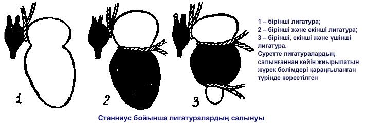 Станниус бойынша лигатуралардың салынуы